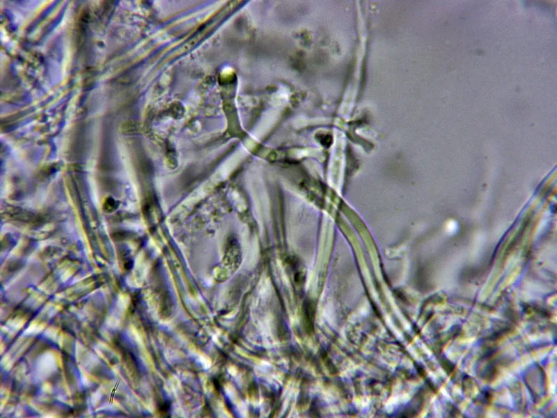 Flavidoporia mellita 10 - Hifas KOH 2